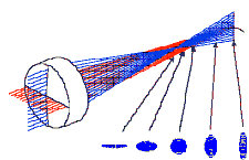 astigmatism